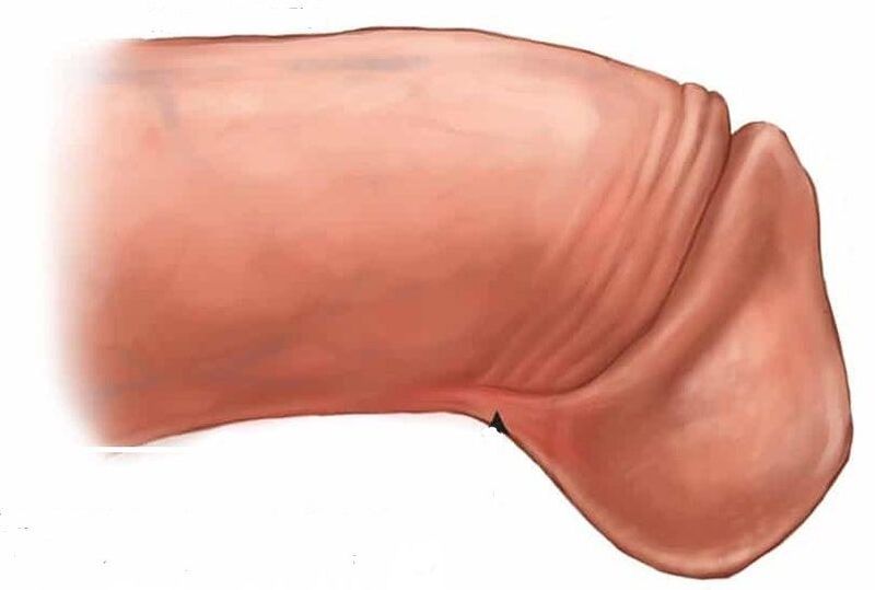 cum să măriți glandul penisului